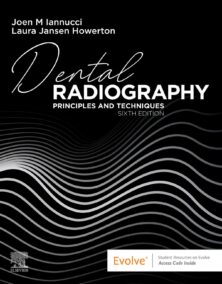 Dental Radiography: Principles and Techniques